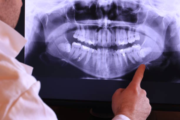 Best Emergency Dentist for Special Needs Patients in Five Forks, SC