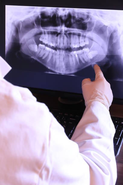Best Emergency Dentist for Lost Fillings or Crowns in Five Forks, SC